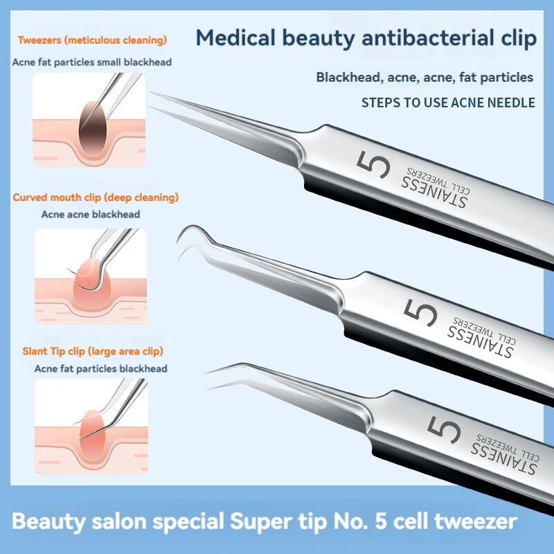 Luxury Skincare Acne - 7 Stuks Roestvrijstalen Splinter Acne Clip