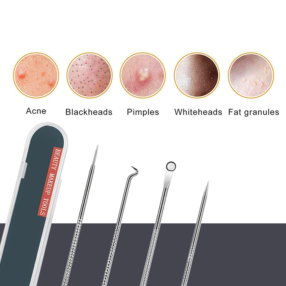 Pimple Popper Tool Kit Mee-ete - Luxury Skincare Acne recensie en prijs