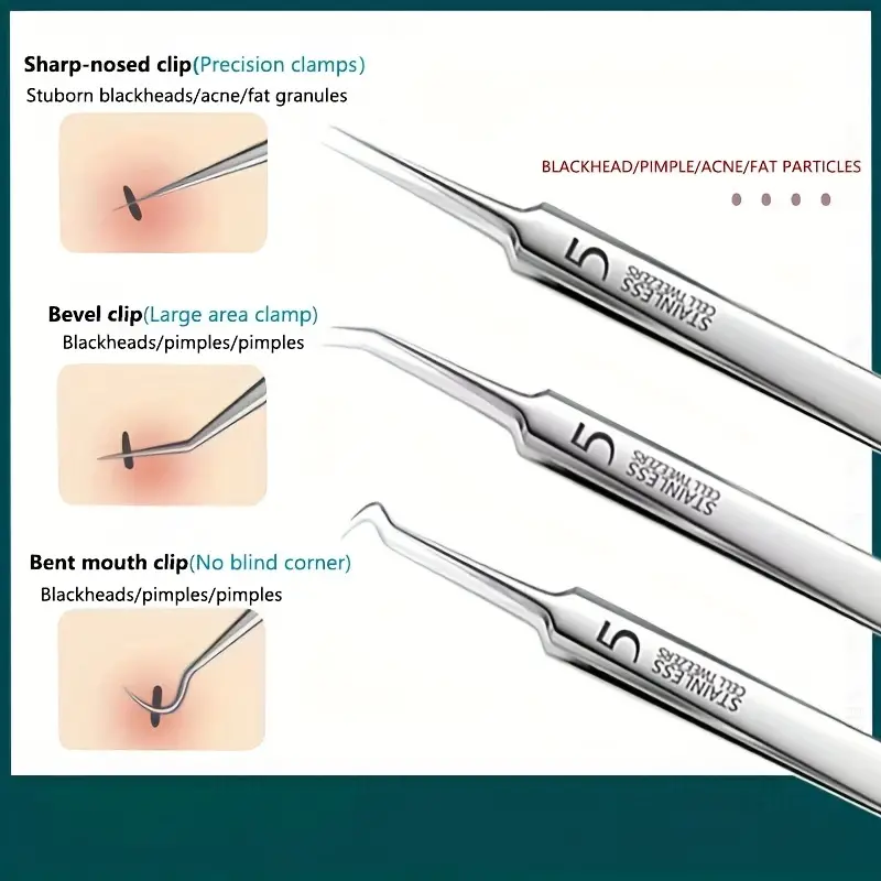 3-8 Stuks Acne Naald Tool Set  - Luxury Skincare Acne recensie en prijs