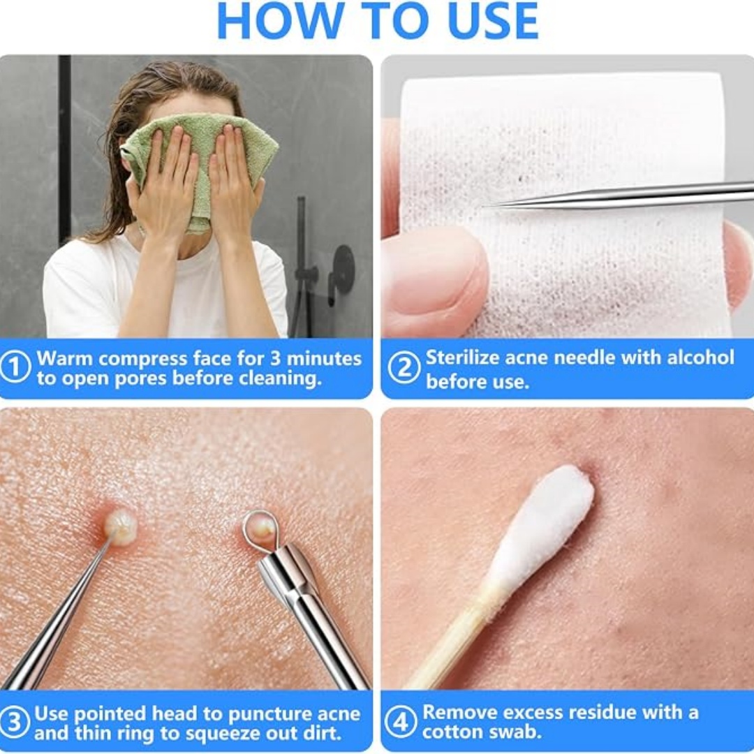 5-delige set voor het verwijde - Luxury Skincare Acne recensie en prijs